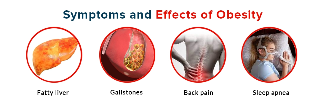 Symptoms and Effects of Obesity